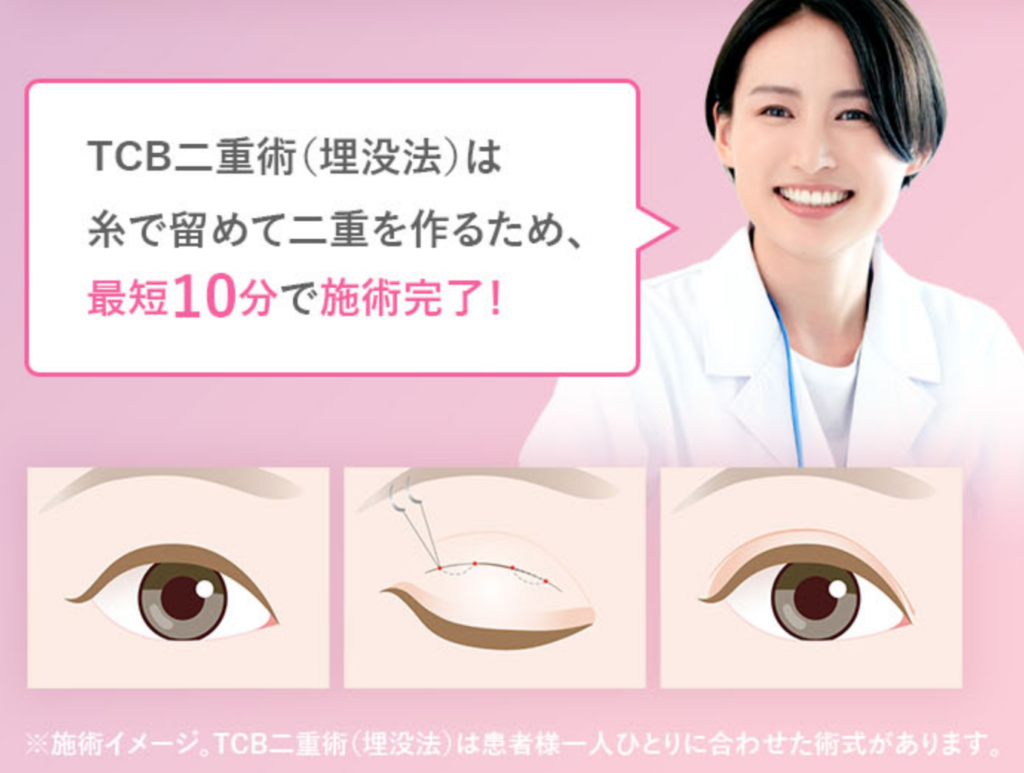 TCB東京中央美容外科の二重整形が4800円って本当？口コミ評判を 