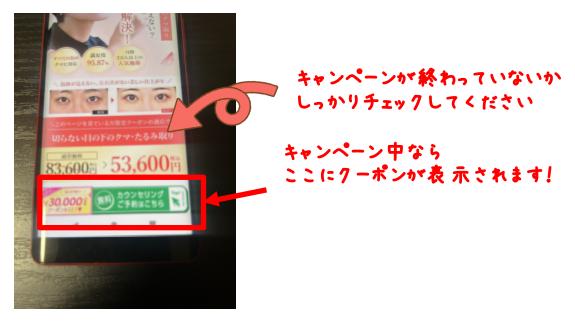 TCB東京中央美容外科の切らないクマ取りを安い料金で受けられるキャンペーンページの詳細